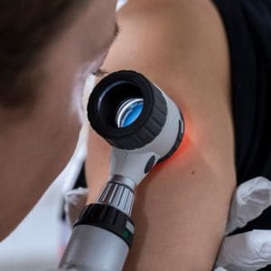 mole check near me