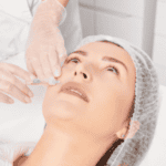 what are anti wrinkle injections